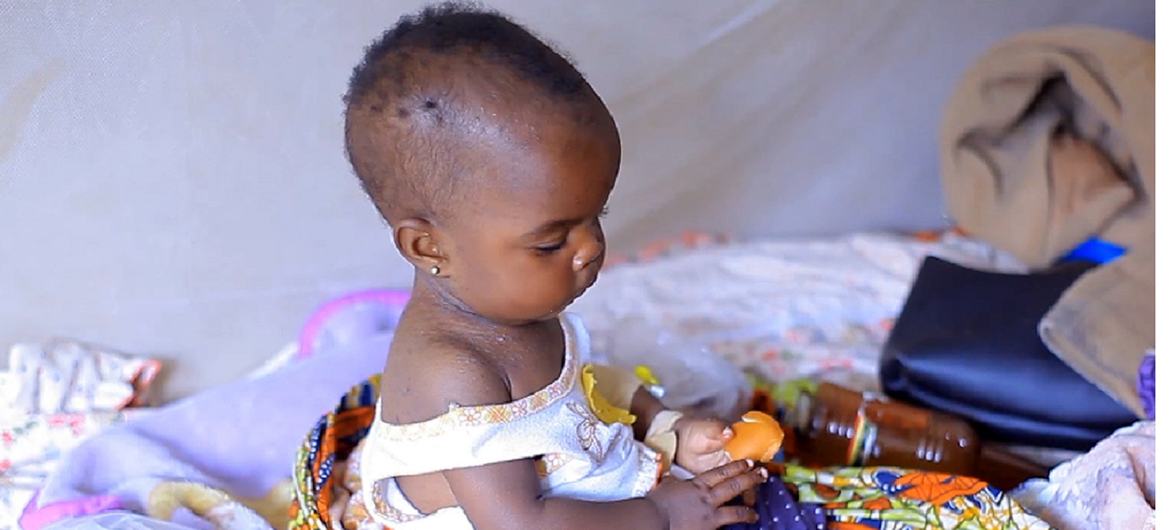 A child recovering from malaria at the Gracia Health Center in Beni town, in the Democratic Republic of the Congo's province of North Kivu A child recovering from malaria at the Gracia Health Center in Beni town, in the Democratic Republic of the Congo's province of North Kivu